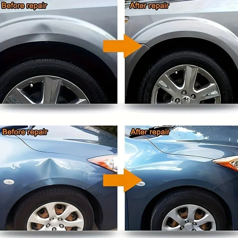 Car Dent Puller Repair Kit 🚗✨